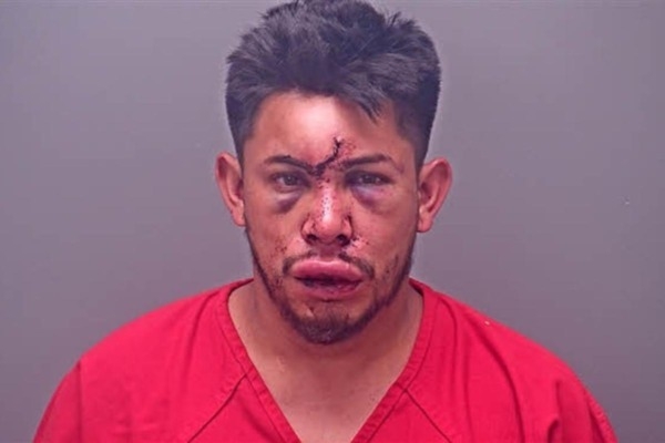 Un garçon de 13 ans assomme sauvagement son père ivre pour l’empêcher d’étrangler sa mère